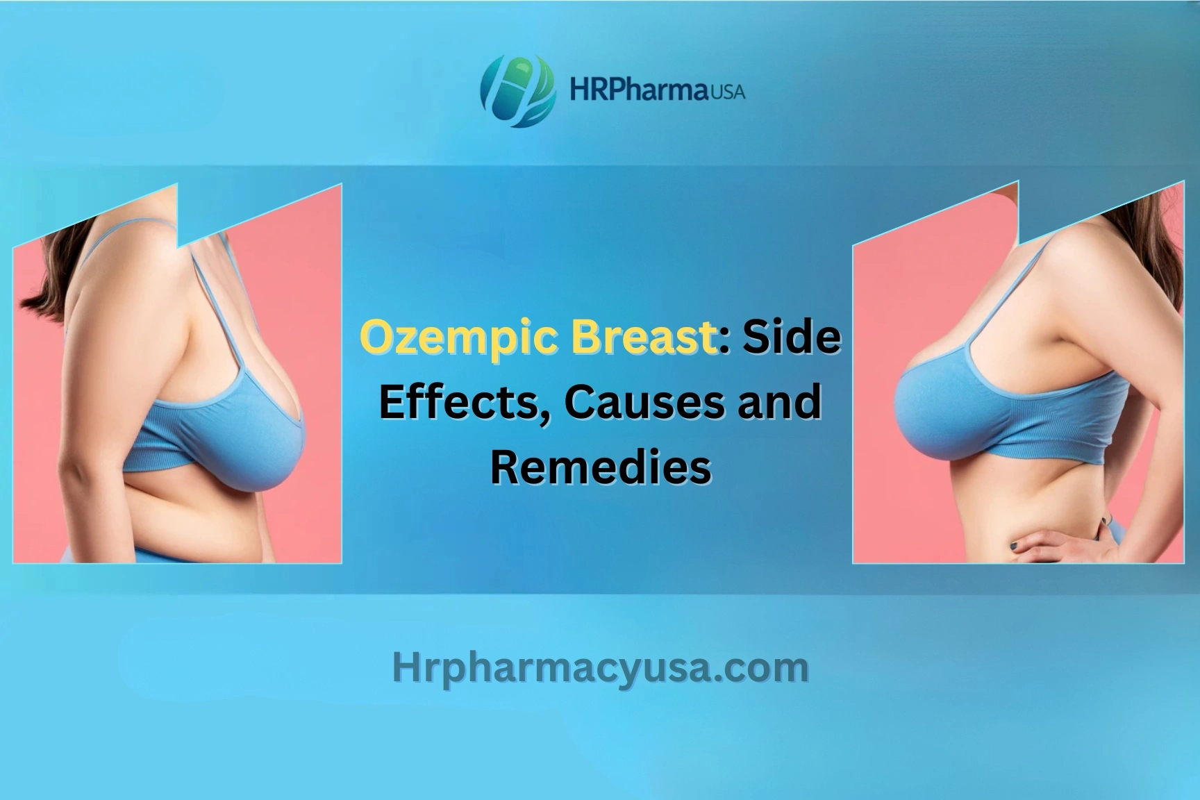 Ozempic Breast: Side Effects, Causes and Remedies