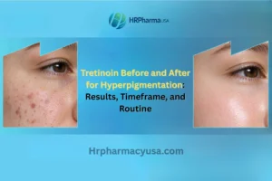 Tretinoin Before and After for Hyperpigmentation: Results, Timeframe, and Routine
