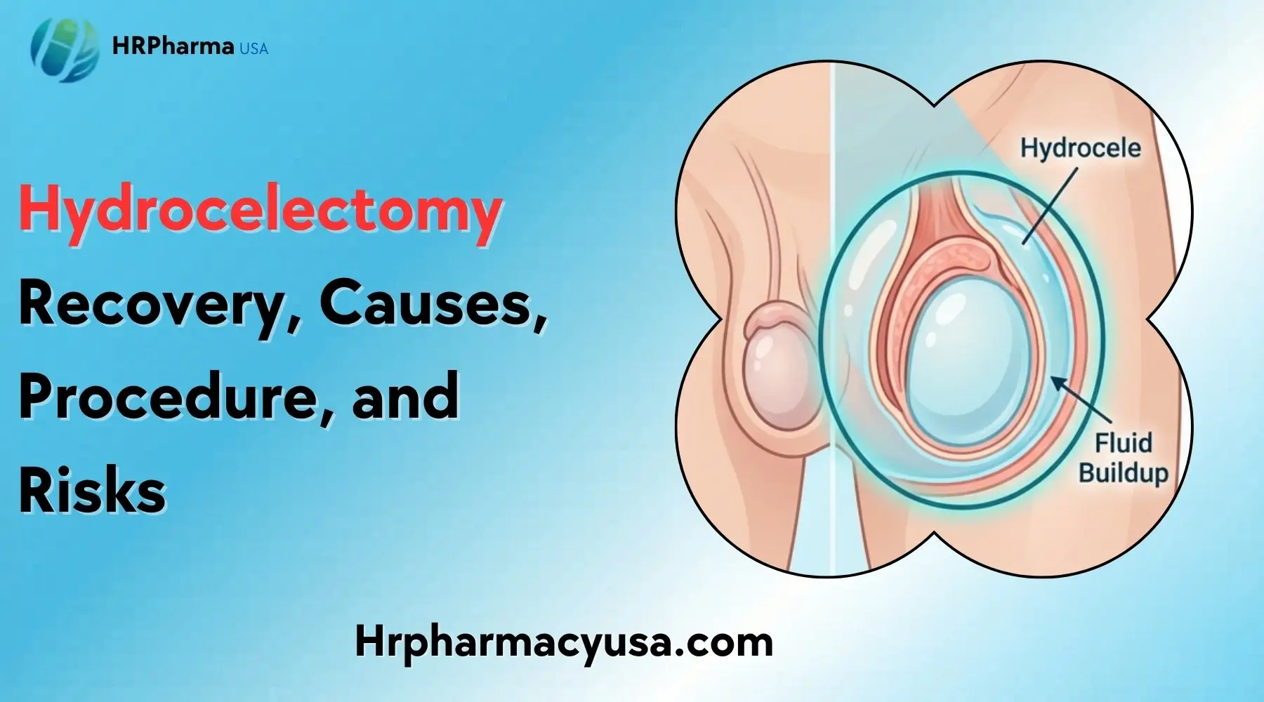 Hydrocelectomy: Recovery, Causes, Procedure, and Risks