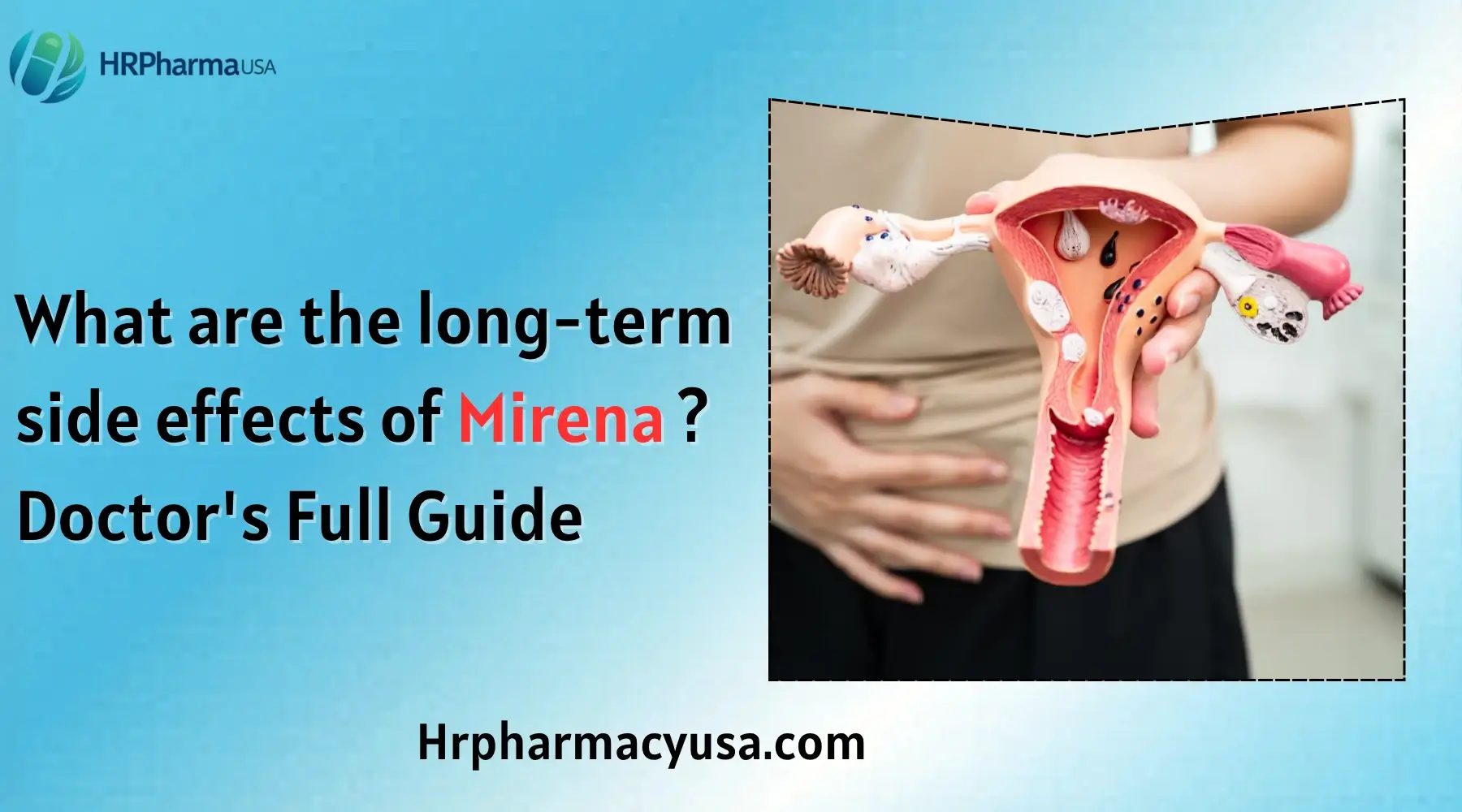 What are the long-term side effects of Mirena Doctor's Full Guide